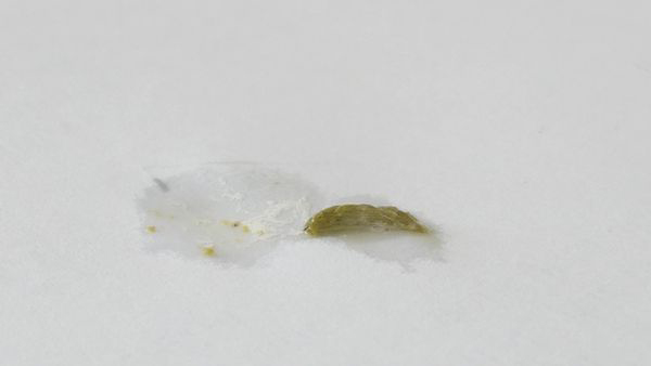 Unhealthy Budgie Poop